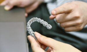 Invisalign: What’s All the Hype About?