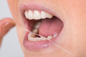 5 Tips to Step Up Your Home Dental Care